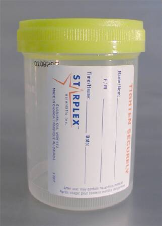 Specimen Container for Pneumatic Tube Systems Starplex® 120 mL (4 oz.) Screw Cap Patient Information Sterile Inside Only