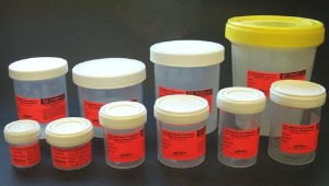 Prefilled Formalin Container SP® 30 mL Fill in 60 mL (2 oz.) Screw Cap Warning Label / Patient Information NonSterile